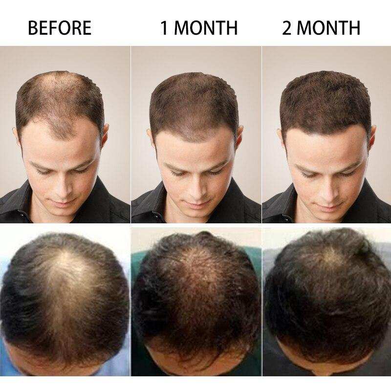 Hair Growth Essential Oil
